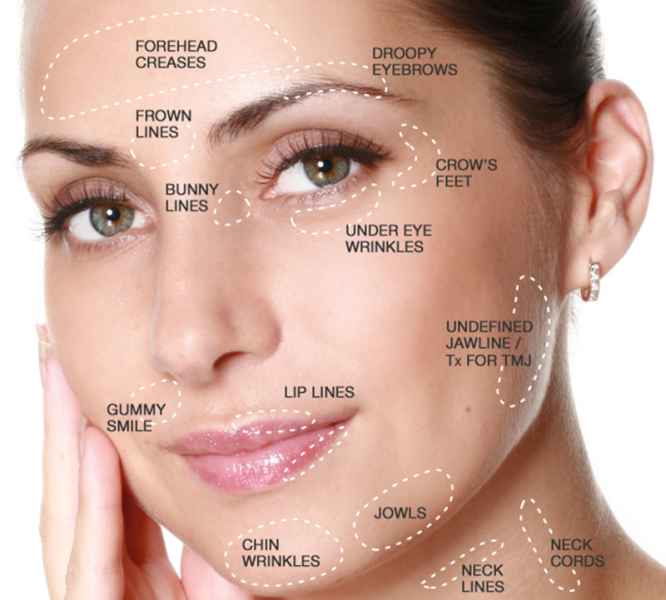 Botox ukljanjanje bora - DKC Farah