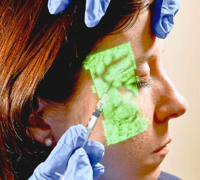 Vein Viewer - DKC Farah Tuzla i Sarajevo